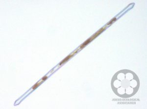Synedra sp. (Photo: Nagyapáti Sarolta)